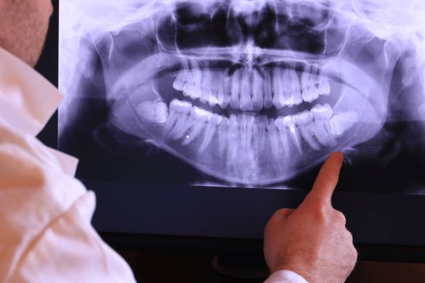 Best Emergency Broken Tooth Repair in Kings Bay Base, GA